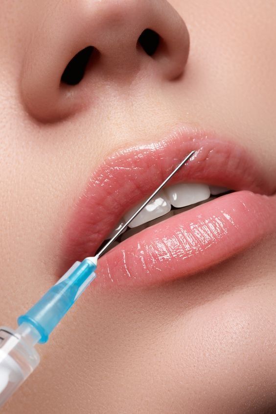 Aplicação de Botox / Toxina Botulínica