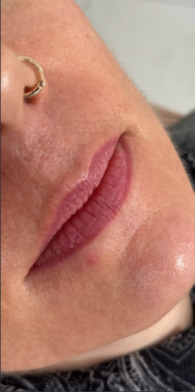 Antes da harmonização