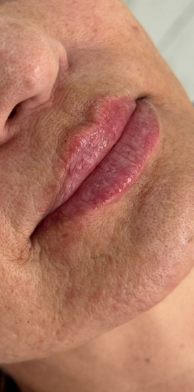 Depois da harmonização